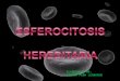 Esferocitosis hereditaria