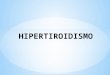 Hipertiroidismo okkkk
