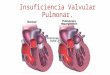 Insuficiencia Valvular Pulmonar