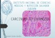 Carcinoma epidermoide