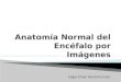 Anatomía normal del encéfalo por imágenes