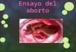 ENSAYO  DEL ABORTO