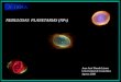 Nebulosa Planetarias N Ps Acodea Juan Jose Pineda