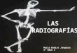 las radiografias