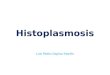 Histoplasmosis   ospino