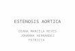 Presentacion Estenosis Aortica