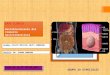 Caso clínico  tumor del estroma gastrointestinal- dr jurado