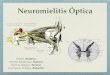 NMO (neuromielitis óptica)