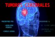 Tumores cerebrales completo neurocirugía
