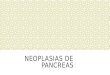 Neoplasias de pancreas y vesicula biliar