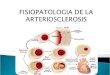 fisiopatologia de la arteriosclerosis