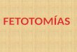 Fetotomia en obstetricia