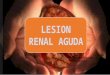 Lesion renal aguda