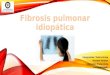 Fibrosis Pulmonar Idiopatica