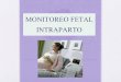 Monitoreo Electrónico Fetal Intraparto