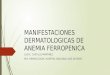 Manifestaciones Dermatologicas de Anemia Ferropenica