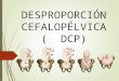 desproporcion CEFALOPELVICA