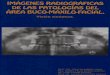 Imágenes Radiográficas de Las Patologías Del Área Buco-Maxilofacial (1)