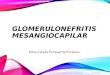 Glomerulonefritis Mesangiocapilar (1) (1).pptx