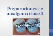 Preparaciones de amalgama clase II.pptx