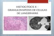 Histiocitosis X