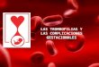 Trombofilia Ppt Valeria Leroyerpelle29abril