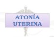 ATONIA UTERINA.pptx