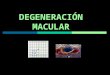 Degeneración Macular