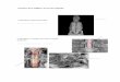 Anatomía de La Médula y Los Nervios Espinales