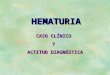 Caso Clinico de Hematuria