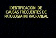14. Identif de Causas Frecuentes de Patolog Intracraneal Para EXPO