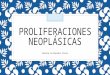 Proliferaciones neoplásicass.pptx