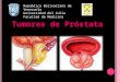 Tumores de Prostata