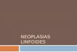 NEOPLASIAS LINFOIDES 2