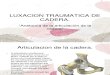 LUXACION TRAUMATICA DE CADERA.ppt
