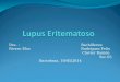 Lupus Eritematoso
