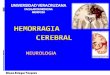 Hemorragia Cerebral