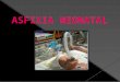 Diapositivas Asfixia Neonatal Trabajo