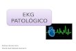 EKG Patologico.pptx