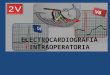 Electrocardiografia Intraoperatoria Oaxaca