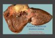 Endocarditis infecciosa - Dr. Josías Ríos Ortega