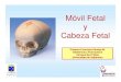 6 Móvil Fetal y Cabeza Fetal FPM [Modo de compatibilidad]