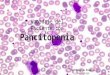 02- Abordaje Del Paciente Con Pancitopenia 08-May-13
