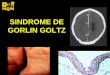 Sindrome Gorlin Goltz