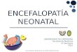 Encefalopatía Neonatal