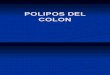 Polipos Del Colon