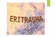 Eritrasma Micologia