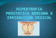 HIPERTROFIA PROSTATICA BENIGNA E IRRIGACCION VESICAL.pptx