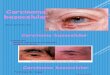 carcinma basocelular oftalmo