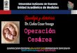 Operacion Cesarea